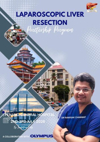 Laparoscopic Liver Resection Proctorship Program